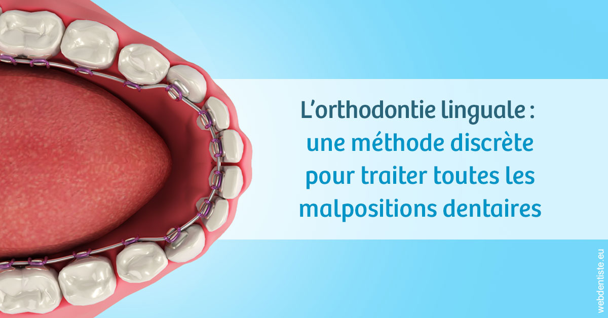 https://dr-langlade-philippe.chirurgiens-dentistes.fr/L'orthodontie linguale 1