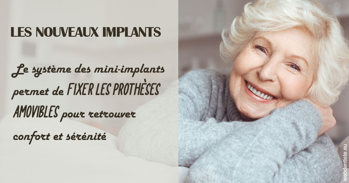 https://dr-langlade-philippe.chirurgiens-dentistes.fr/Les nouveaux implants 1