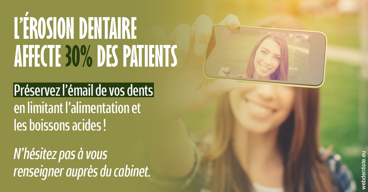https://dr-langlade-philippe.chirurgiens-dentistes.fr/L'érosion dentaire 1