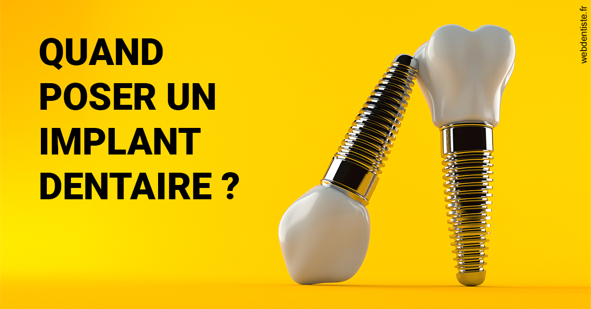 https://dr-langlade-philippe.chirurgiens-dentistes.fr/Les implants 2
