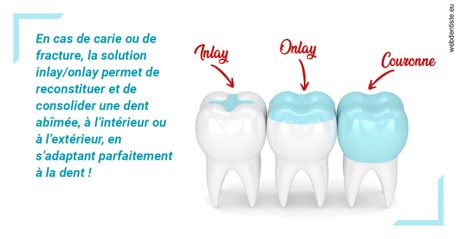 https://dr-langlade-philippe.chirurgiens-dentistes.fr/L'INLAY ou l'ONLAY