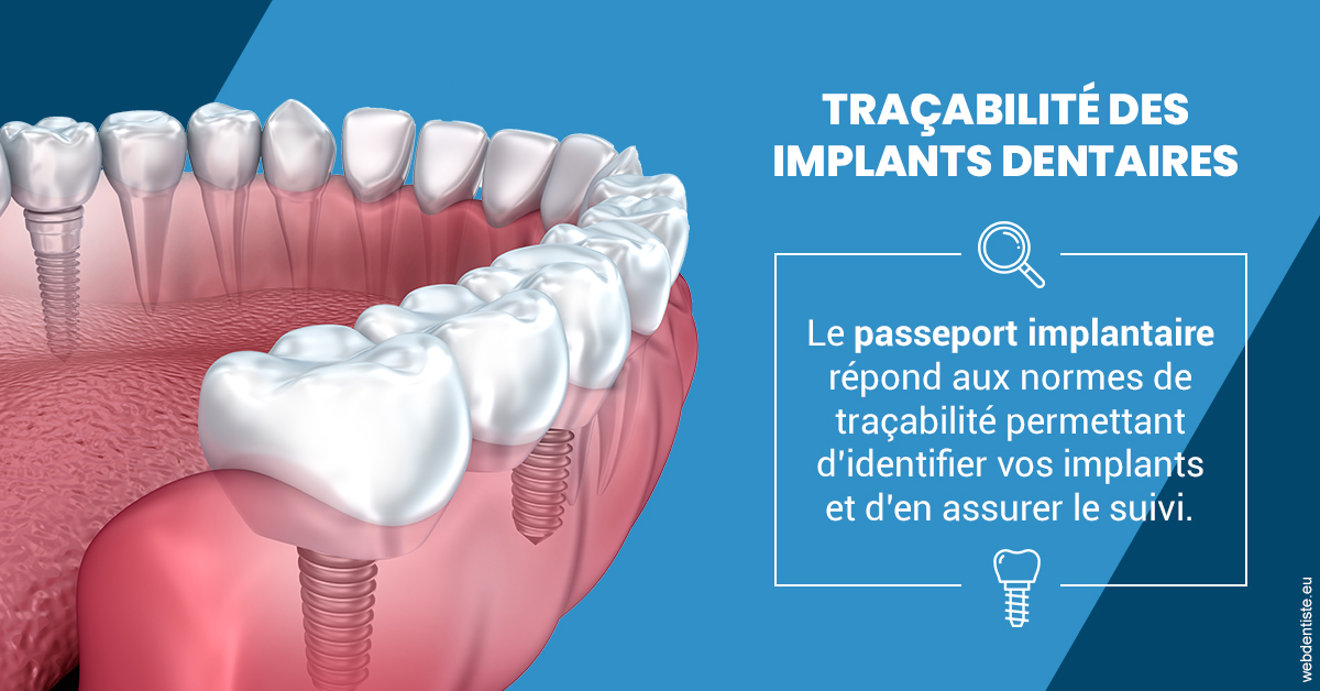 https://dr-langlade-philippe.chirurgiens-dentistes.fr/T2 2023 - Traçabilité des implants 1