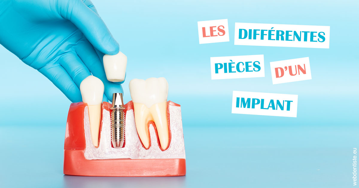 https://dr-langlade-philippe.chirurgiens-dentistes.fr/Les différentes pièces d’un implant 2