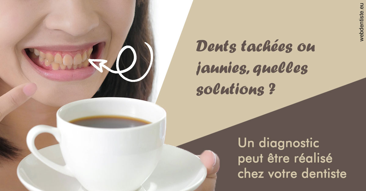 https://dr-langlade-philippe.chirurgiens-dentistes.fr/Dents tachées 1