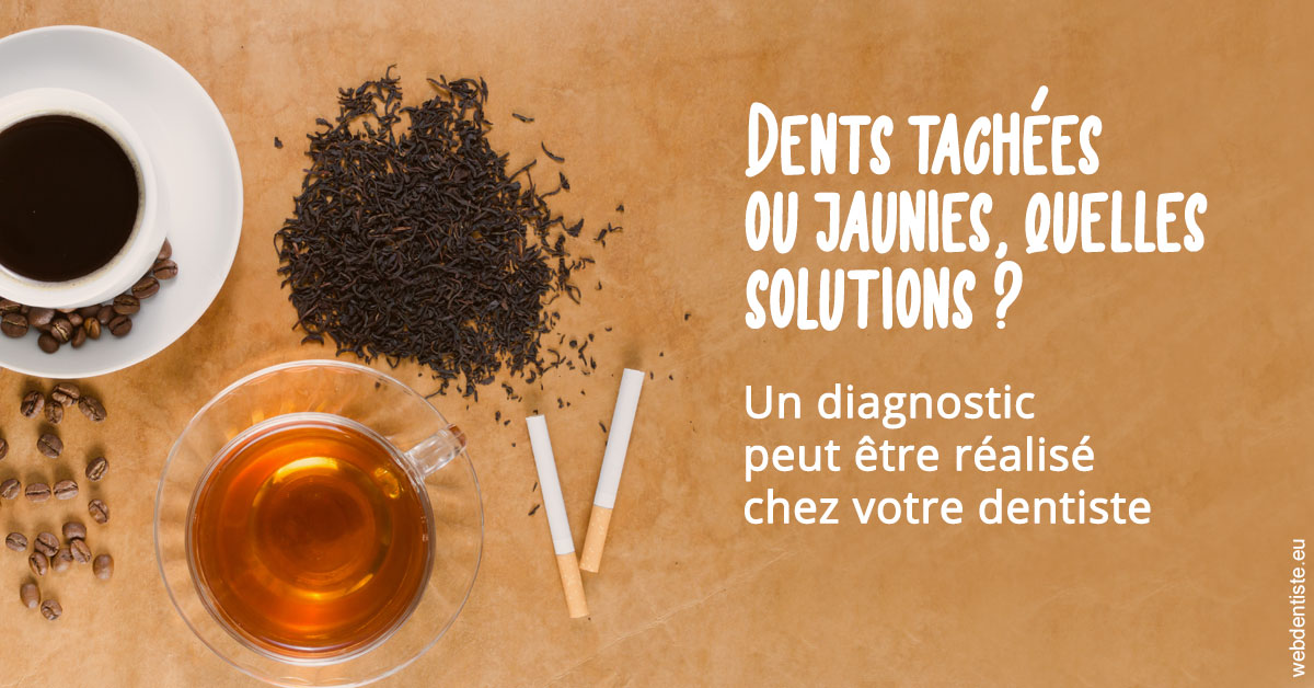 https://dr-langlade-philippe.chirurgiens-dentistes.fr/Dents tachées 2
