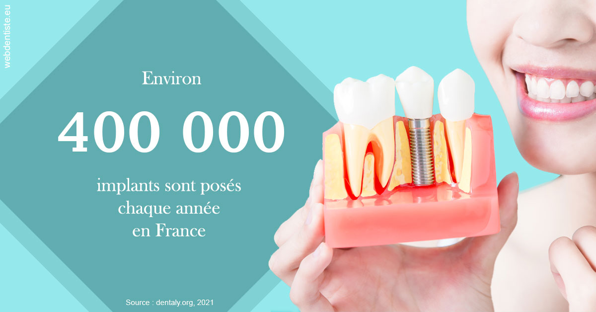 https://dr-langlade-philippe.chirurgiens-dentistes.fr/Pose d'implants en France 2