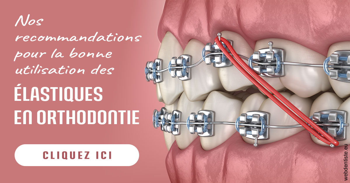https://dr-langlade-philippe.chirurgiens-dentistes.fr/Elastiques orthodontie 2